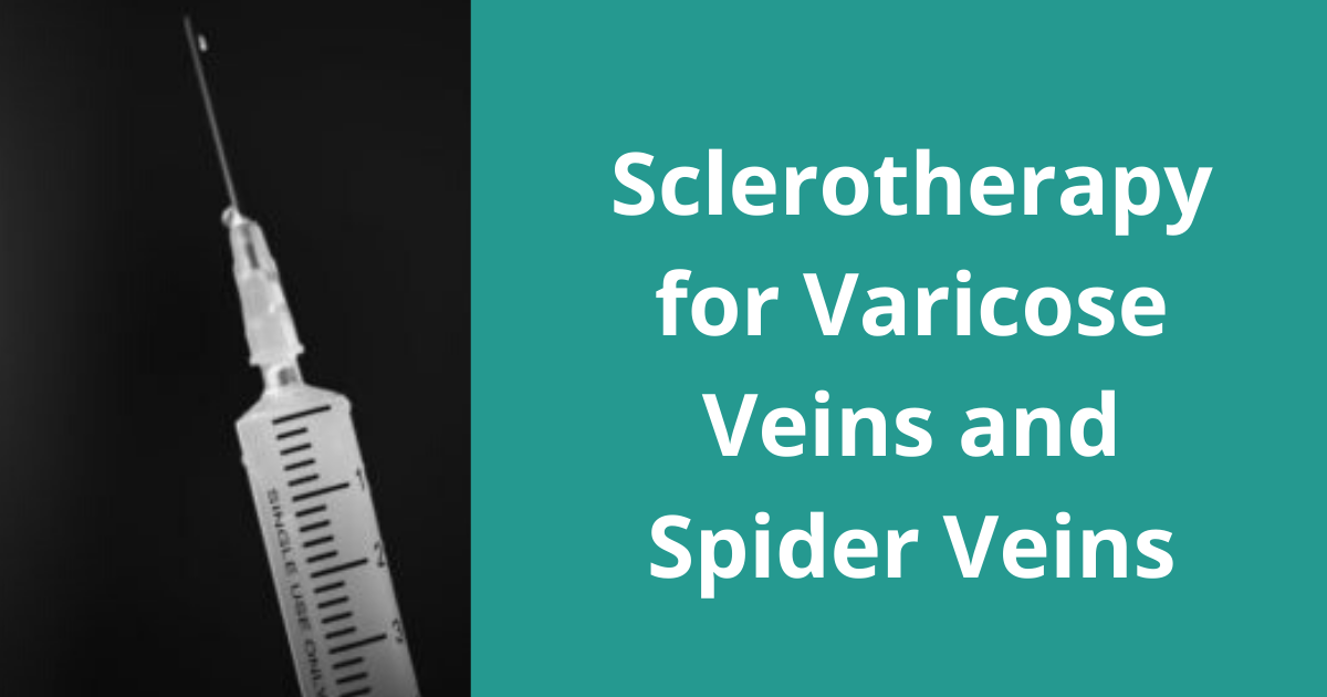 Sclerotherapy for Varicose Veins and Spider Veins