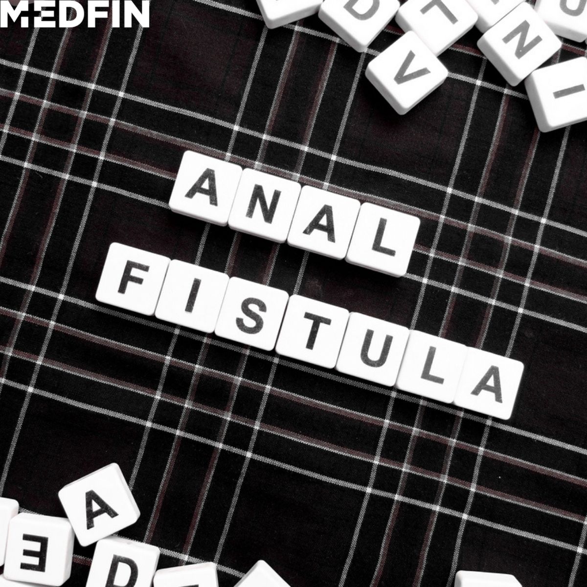 What Is An Anal Fistula? Here’s Everything You Need To Know About It!